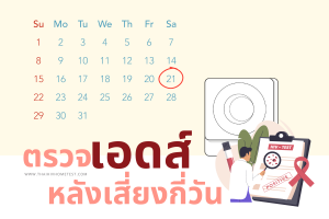 ตรวจเอดส์ หลังเสี่ยงกี่วัน