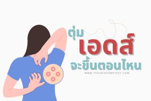 ตุ่มเอดส์จะขึ้นตอนไหน รู้จักอาการสำคัญของเอชไอวี พร้อมแนวทางตรวจที่ถูกต้อง